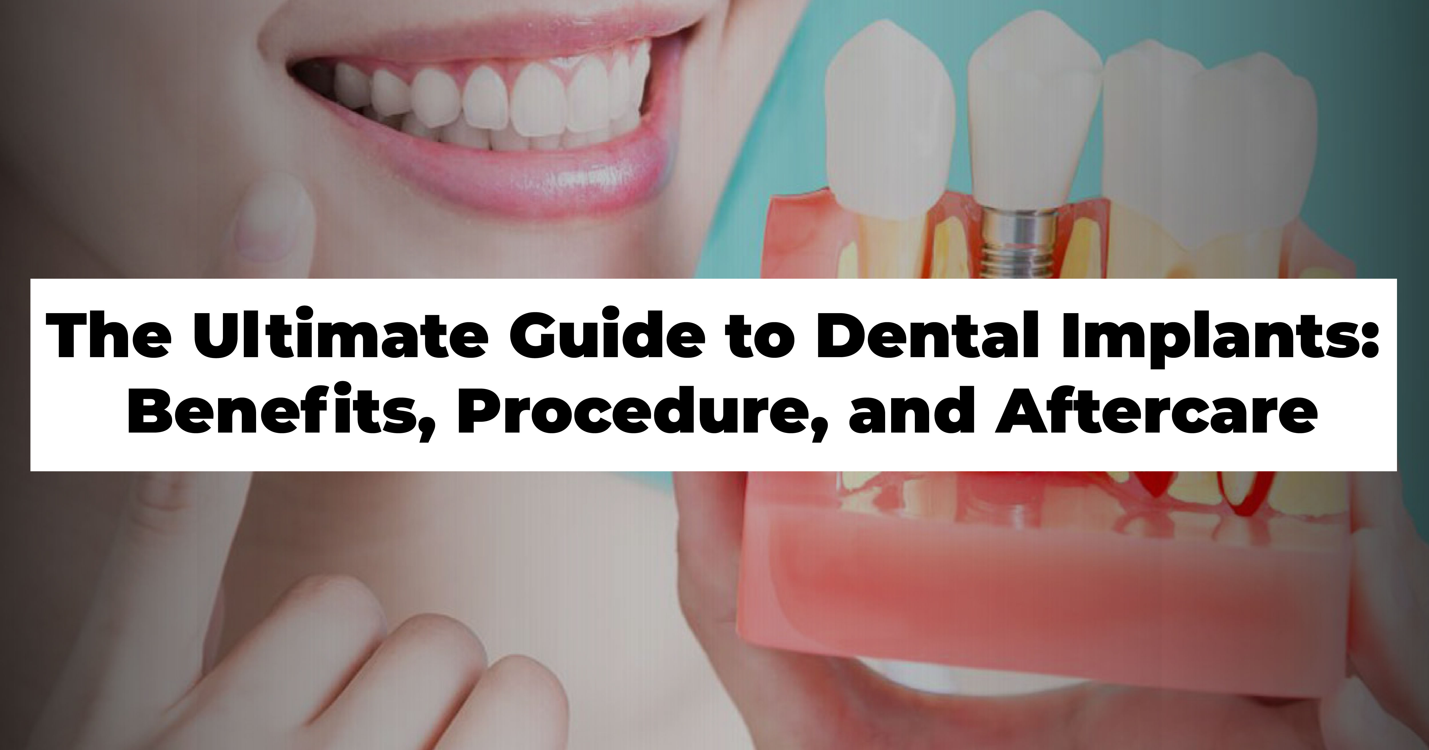 https://venunaddental.com.lttrbx.in/uploaded_file/files/img/news/dental implants